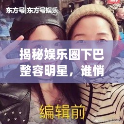 揭秘娱乐圈下巴整容明星，谁悄悄整过下巴？