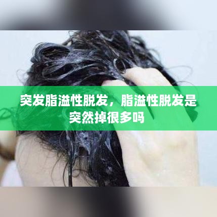 突发脂溢性脱发，脂溢性脱发是突然掉很多吗 