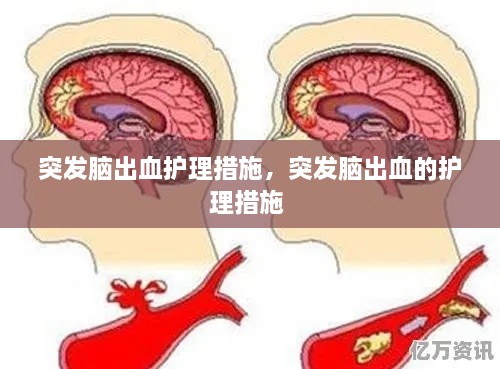 突发脑出血护理措施，突发脑出血的护理措施 