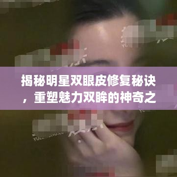 揭秘明星双眼皮修复秘诀，重塑魅力双眸的神奇之旅