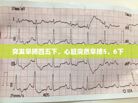 突发早搏四五下，心脏突然早搏5、6下 