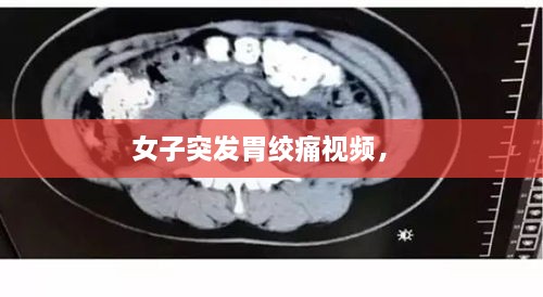 女子突发胃绞痛视频， 