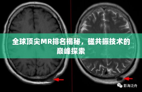 全球顶尖MR排名揭秘，磁共振技术的巅峰探索