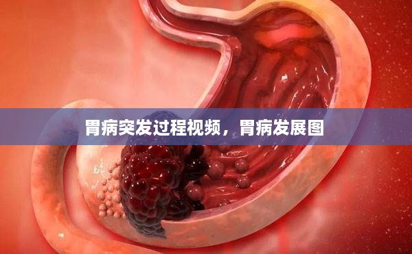 胃病突发过程视频，胃病发展图 