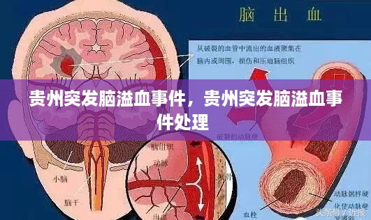 贵州突发脑溢血事件，贵州突发脑溢血事件处理 